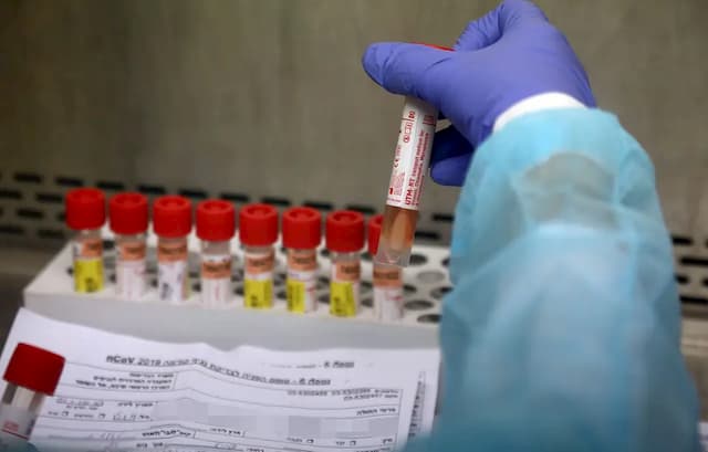 The Nouvelle-Aquitaine Region has 1000 confirmed coronavirus cases