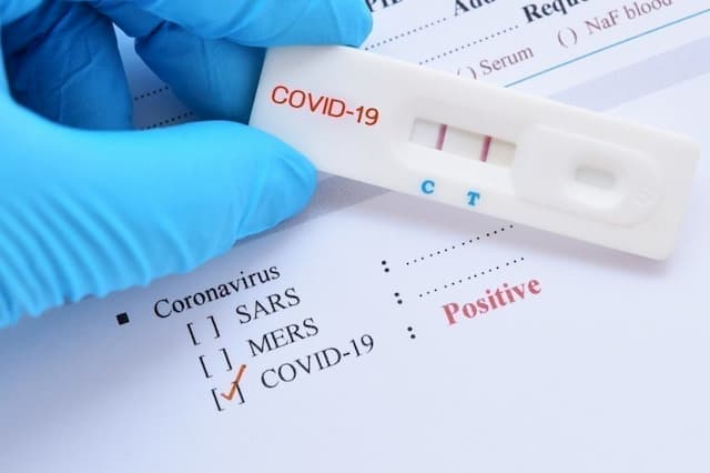 The threshold for people infected with Covid-19 and in intensive care has been negative for 15 days, this Wednesday, April 22, 2020.
