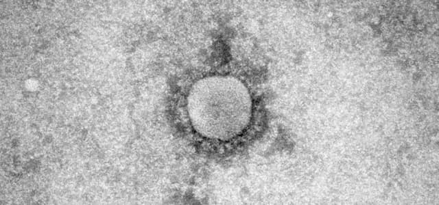 Two Cases of MERS-CoV Detected in France: Health Authorities Step Up Precautions After Travelers Return from the Arabian Peninsula