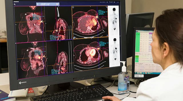 Big step in France’s fight against cancer!